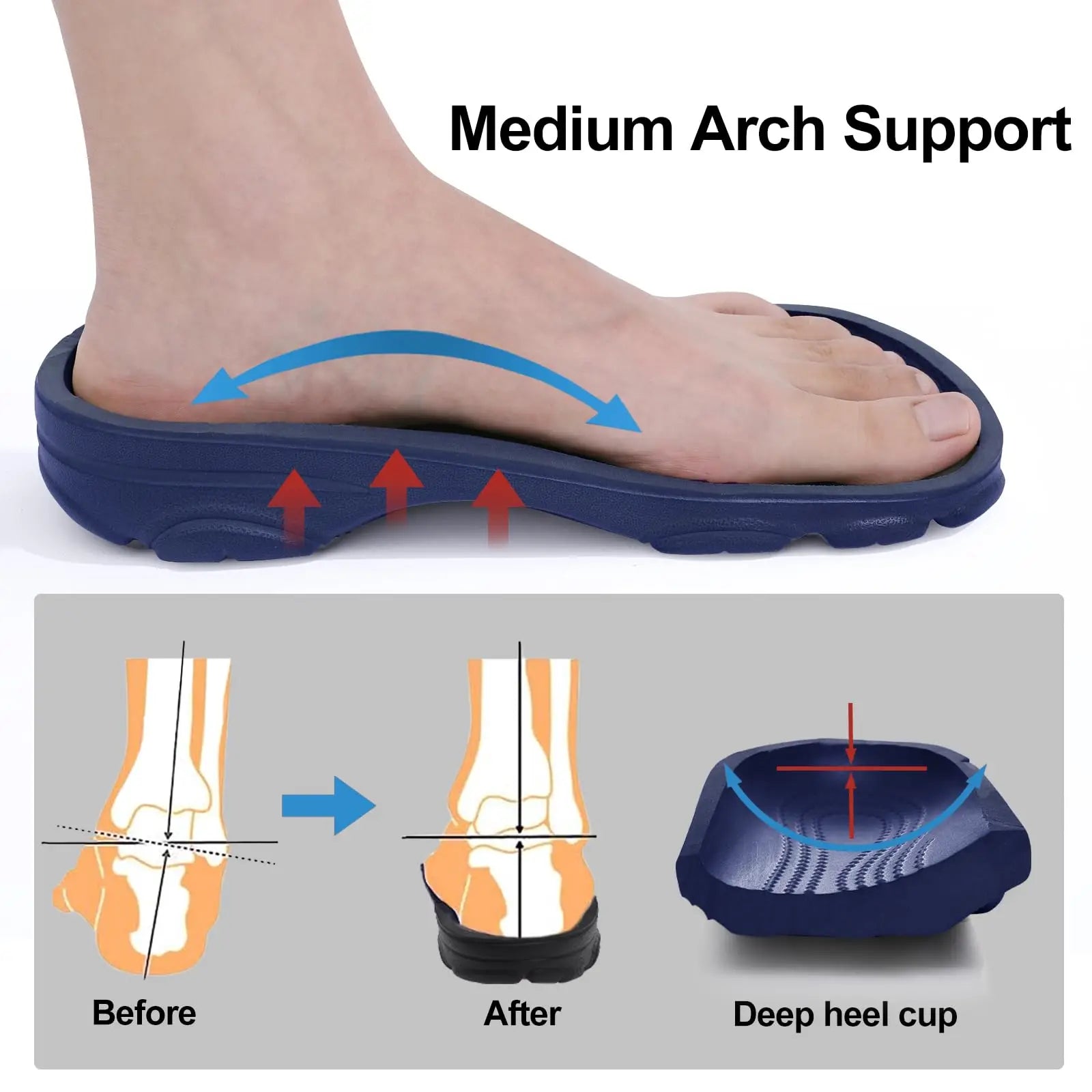 Comwarm Men's Arch Support Clogs – Orthopedic EVA Sandals for Foot Relief
